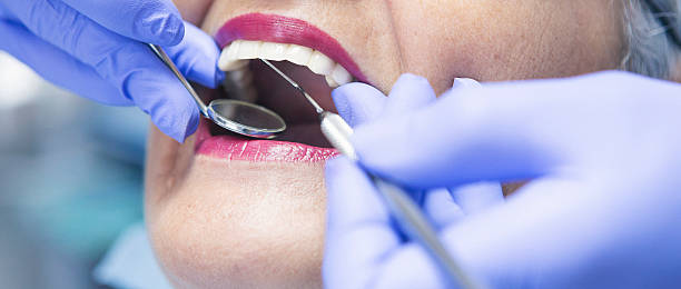 Best Emergency Tooth Extraction in Sandwich, IL